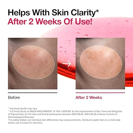 Anua Niacinamide 10 + TXA 4 Serum cart saudia
