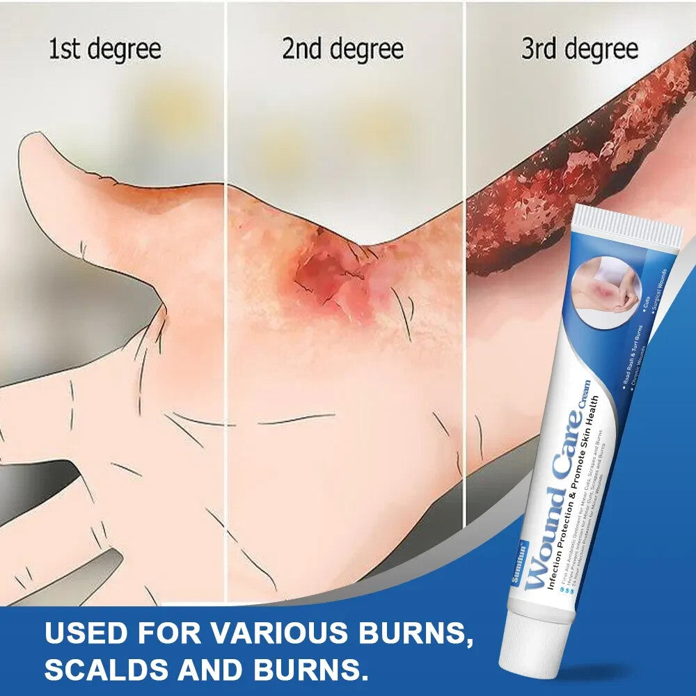 Burn Ointment Burning Wound Care Anti-Infection Cream Antibacterial Skin Healing Burn Ointment 20g